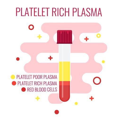 Platelet-Rich Plasma Therapy