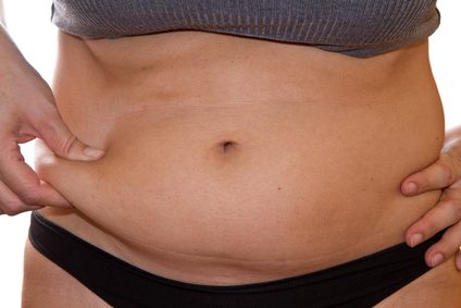 Tumescent Liposuction Q&A